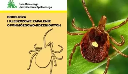 Borelioza i kleszczowe zapalenie opon mózgowo-rdzeniowych