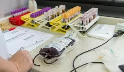 Jutro zbiórka krwi w Środzie Śląskiej